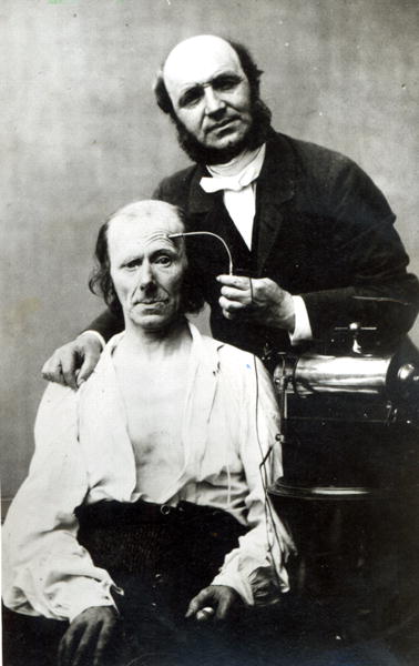 Duchenne de Boulogne with a ''victim patient'', 1862 (b/w photo)  a French Photographer