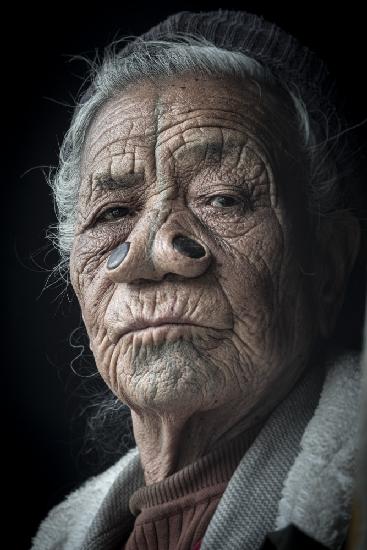 Apatani elder at Ziro valley, Arunachal Pradesh