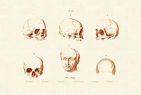 Phrenology