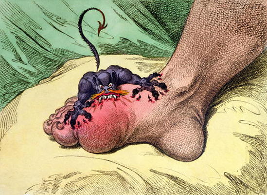 The Gout, published by Hannah Humphrey in 1799 (hand-coloured softdground etching) a James Gillray