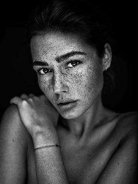 Freckles [Romi]
